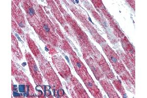 Immunohistochemistry (IHC) image for anti-Succinate Dehydrogenase Complex, Subunit B, Iron Sulfur (Ip) (SDHB) (C-Term) antibody (ABIN185447)