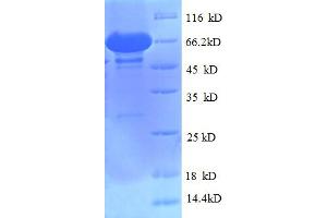 SDS-PAGE (SDS) image for Nuclear Receptor Subfamily 1, Group H, Member 4 (NR1H4) (AA 1-476), (Isoform 3) protein (His-SUMO Tag) (ABIN5711587)