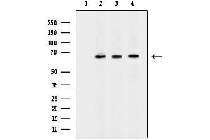 Western blot analysis of lysates from Rat liver Mouse brain, using CES1 Antibody.