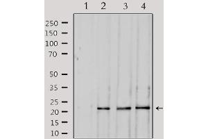 Western blot analysis of extracts from various samples, using SOCS2 Antibody.