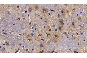 Detection of NPS in Rat Cerebrum Tissue using Polyclonal Antibody to Neuropeptide S (NPS) (NPS 抗体  (AA 26-89))