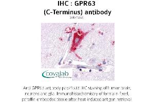 Image no. 1 for anti-G Protein-Coupled Receptor 63 (GPR63) (C-Term) antibody (ABIN1735144)