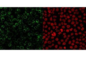 Immunofluorescent staining of paraformaldehyde-fixed Raji cells.