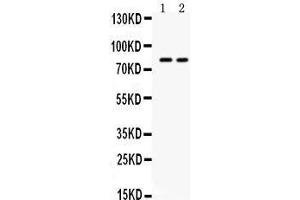 Western blot analysis of ZP2 expression in HELA whole cell lysates (lane 1) and HEPG2 whole cell lysates (lane 2). (ZP2 抗体  (N-Term))