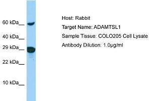 Host: Rabbit Target Name: ADAMTSL1 Sample Type: COLO205 Whole Cell lysates Antibody Dilution: 1.