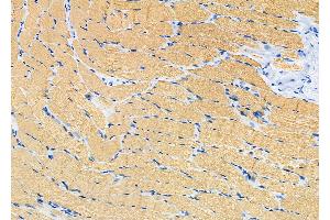 ABIN6266284 and ABIN6277438 at 1/100 staining Rat muscle tissue by IHC-P.
