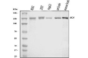 Western blot analysis of Bcr using anti-Bcr antibody (ABIN4886483).
