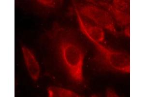Immunofluorescence staining of methanol-fixed Hela cells showing cytoplasmic staining using MKK6(Phospho-Ser207) Antibody. (MAP2K6 抗体  (pSer207))
