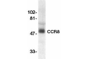 Western Blotting (WB) image for anti-Chemokine (C-C Motif) Receptor 8 (CCR8) antibody (ABIN2472922) (CCR8 抗体)