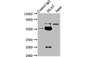 Immunoprecipitating DLAT in HepG2 whole cell lysate Lane 1: Rabbit control IgG instead of ABIN7149908 in HepG2 whole cell lysate. (DLAT 抗体  (AA 26-217))