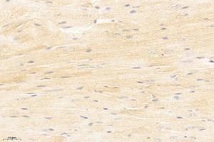 Immunohistochemistry analysis of paraffin-embedded mouse heart using,MYLK3 (ABIN7074736) at dilution of 1: 1200 (MYLK3 抗体)