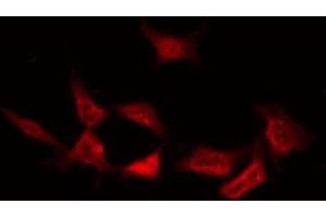 ABIN6267619 staining NIH-3T3 by IF/ICC. (PKC delta 抗体  (pTyr64))
