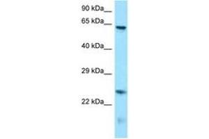 Image no. 1 for anti-Runt-Related Transcription Factor 1, Translocated To, 1 (Cyclin D-Related) (RUNX1T1) (N-Term) antibody (ABIN6748227) (RUNX1T1 抗体  (N-Term))
