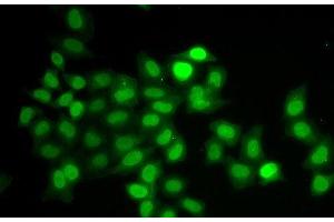 Immunofluorescence analysis of U2OS cells using MAD1L1 Polyclonal Antibody (MAD1L1 抗体)