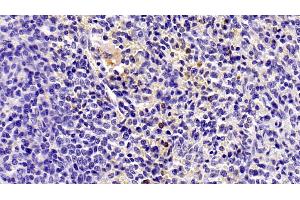 Detection of IL8 in Human Spleen Tissue using Monoclonal Antibody to Interleukin 8 (IL8) (IL-8 抗体  (AA 28-99))