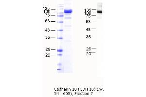 Western Blotting (WB) image for Cadherin 18, Type 2 (CDH18) (AA 54-608) protein (MBP tag) (ABIN3090475)