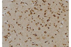 ABIN6277006 at 1/100 staining Human brain tissue by IHC-P.