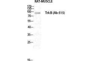 Western Blot (WB) analysis of Rat Muscle cells using Trk B Polyclonal Antibody. (TRKB 抗体  (Thr185))