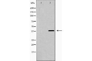 Western blot analysis of LEG9 expression in HepG2 cells,The lane on the left is treated with the antigen-specific peptide. (Galectin 9 抗体  (Internal Region))