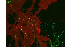 Immunocytochemistry (ICC) image for anti-Solute Carrier Family 1 (Glial High Affinity Glutamate Transporter), Member 3 (SLC1A3) (Cytoplasmic Domain) antibody (ABIN2690503)