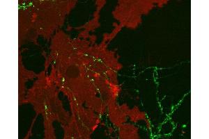 Indirect immunostaining of cultured rat astrocytes and hippocampus neurons with anti-EAAT 1 (dilution 1 : 1000; red) and mouse anti-synapsin 1 (cat.