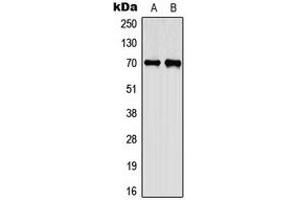 Western blot analysis of CEP70 expression in A549 (A), PC12 (B) whole cell lysates. (CEP70 抗体  (Center))