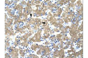 Image no. 1 for anti-Acetyl-CoA Acetyltransferase 2 (ACAT2) (AA 174-223) antibody (ABIN202424) (ACAT2 抗体  (AA 174-223))
