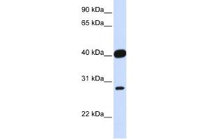 WB Suggested Anti-ELK3 Antibody Titration:  0. (ELK3 抗体  (Middle Region))