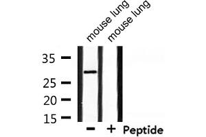 Western blot analysis of extracts from mouse lung, using RNF144A Antibody. (RNF144A 抗体  (Internal Region))