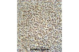 Immunohistochemistry (Paraffin-embedded Sections) (IHC (p)) image for anti-Zinc Finger CCCH-Type Containing 12A (ZC3H12A) (AA 331-358), (Middle Region) antibody (ABIN955634)