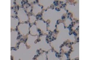 IHC-P analysis of Mouse Tissue, with DAB staining. (GSTA4 抗体  (AA 1-222))