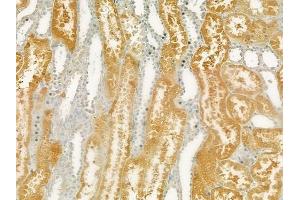 ABIN6265056 and ABIN6277707 at 1/100 staining human normal kidney tissue by IHC-P. (SH3G2 抗体  (Internal Region))