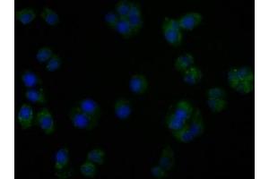 Immunofluorescence staining of PC3 cells with ABIN7140185 at 1:50, counter-stained with DAPI. (TGFBR3L 抗体  (AA 242-258))