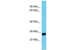 Host: Rabbit Target Name: FAM204A Sample Type: Jurkat Whole Cell lysates Antibody Dilution: 1. (FAM204A 抗体  (N-Term))