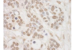 anti-Ribosomal Protein S6 Kinase A4 (RPS6KA4) (AA 722-772) antibody