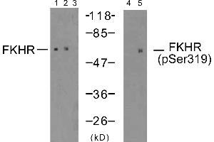 Western blot analysis of extracts using FKHR (Ab-319) antibody (Line 1, 2 and 3) and FKHR (phospho-Ser319) antibody (Line 4 and 5). (FOXO1 抗体  (Ser319))