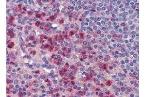 Image no. 1 for anti-Interleukin-27 Subunit alpha (IL27) (Center) antibody (ABIN372920) (IL27 抗体  (Center))