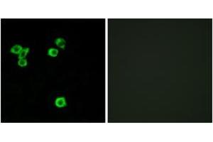 Immunofluorescence analysis of LOVO cells, using RPS6KC1 Antibody. (RPS6KC1 抗体  (AA 231-280))