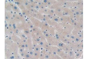 DAB staining on IHC-P;;Samples: Human Liver Tissue (PPM1A 抗体  (AA 2-382))