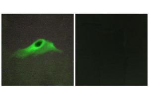 Immunofluorescence (IF) image for anti-Collagen, Type IV, alpha 5 (COL4A5) (N-Term) antibody (ABIN1850286) (COL4a5 抗体  (N-Term))