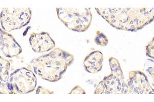 Immunohistochemistry (IHC) image for anti-Interleukin 1 Receptor-Like 1 (IL1RL1) (AA 162-349) antibody (ABIN7437368)