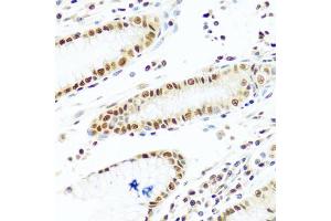Immunohistochemistry of paraffin-embedded human stomach using PRPF19 antibody. (PRP19 抗体)