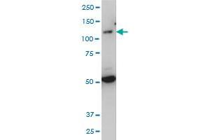 TLR7 monoclonal antibody (M04), clone 2C9 Western Blot analysis of TLR7 expression in IMR-32 . (TLR7 抗体  (AA 27-126))