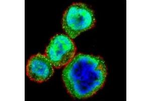 Confocal immunofluorescent analysis of Rb antibody with MDA-MB435 cells followed by Alexa Fluor 488-conjugated goat anti-rabbit lgG (green). (Retinoblastoma Protein (Rb) 抗体  (AA 586-615))