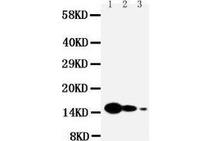 Anti-IL7 antibody, Western blotting Lane 1: Recombinant Mouse IL-7 Protein 10ng Lane 2: Recombinant Mouse IL-7 Protein 5ng Lane 3: Recombinant Mouse IL-7 Protein 2. (IL-7 抗体  (N-Term))