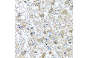 Immunohistochemistry (Paraffin-embedded Sections) (IHC (p)) image for anti-serpin Peptidase Inhibitor, Clade A (Alpha-1 Antiproteinase, Antitrypsin), Member 3 (SERPINA3) (AA 24-423) antibody (ABIN6147571)