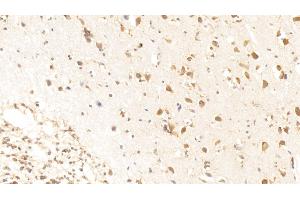 Detection of MST1R in Human Cerebrum Tissue using Polyclonal Antibody to Macrophage Stimulating 1 Receptor (MST1R) (MST1R 抗体  (AA 1092-1316))