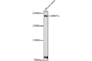 Western blot analysis of extracts of various cell lines, using DNMT1 antibody (ABIN7266810) at 1:1000 dilution. (DNMT1 抗体  (AA 1-270))