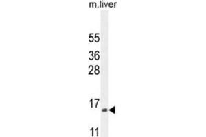 Western Blotting (WB) image for anti-Complexin 3 (CPLX3) antibody (ABIN2995755) (CPLX3 抗体)