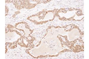Immunohistochemistry (IHC) image for anti-Glutathione S-Transferase pi 1 (GSTP1) (AA 160-210) antibody (ABIN7453941) (GSTP1 抗体  (AA 160-210))
